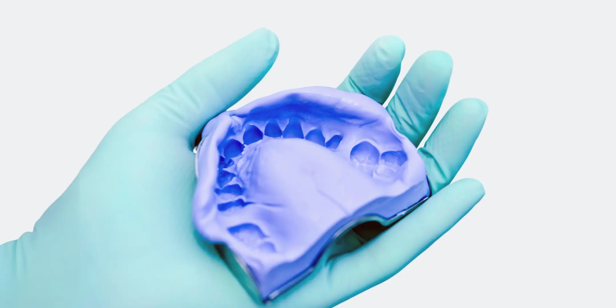 Abformung von Zähnen in der Zahnmedizin mit RTV Silikon